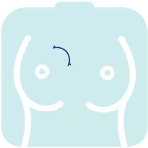 %ce%ba%ce%b1%cf%81%ce%ba%ce%af%ce%bd%ce%bf%cf%82-%cf%84%ce%bf%cf%85-%ce%bc%ce%b1%cf%83%cf%84%ce%bf%cf%8d-5-%cf%83%cf%85%ce%bc%cf%80%cf%84%cf%8e%ce%bc%ce%b1%cf%84%ce%b1-%cf%80%ce%bf%cf%85-%ce%b4%ce%b58