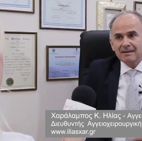 κιρσοί-στην-εγκυμοσύνη-μιλάμε-με-τον-δ