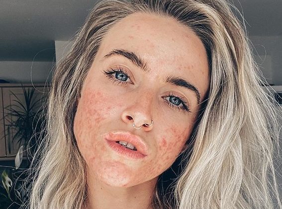 influencer-%ce%bc%ce%b5-%ce%b1%ce%ba%ce%bc%ce%ae-%cf%80%ce%bf%ce%b6%ce%ac%cf%81%ce%b5%ce%b9-%cf%87%cf%89%cf%81%ce%af%cf%82-%ce%bc%ce%b1%ce%ba%ce%b9%ce%b3%ce%b9%ce%ac%ce%b6-%ce%ba%ce%b1%ce%b9-%ce%b40