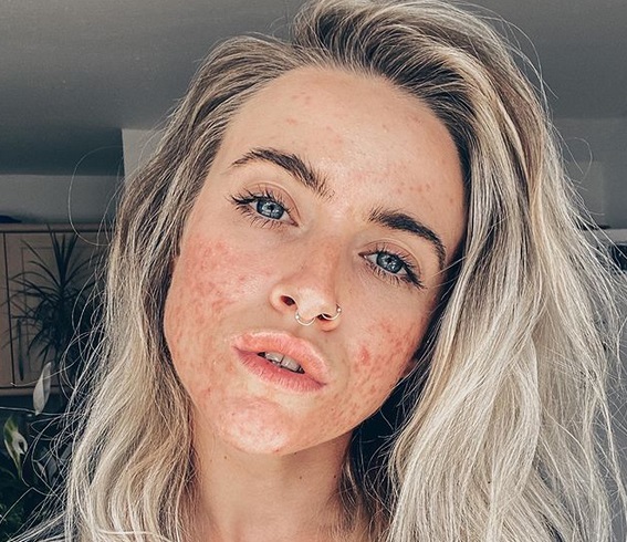 influencer-%ce%bc%ce%b5-%ce%b1%ce%ba%ce%bc%ce%ae-%cf%80%ce%bf%ce%b6%ce%ac%cf%81%ce%b5%ce%b9-%cf%87%cf%89%cf%81%ce%af%cf%82-%ce%bc%ce%b1%ce%ba%ce%b9%ce%b3%ce%b9%ce%ac%ce%b6-%ce%ba%ce%b1%ce%b9-%ce%b40