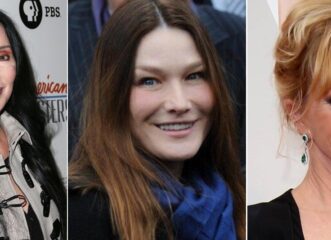 6-celebrities-που-έχουν-παραμορφωθεί-από-τις-πλασ