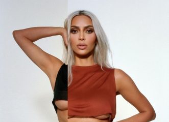 Kim Kardashian: Μας δείχνει την επώδυνη θεραπεία στην οποία υποβλήθηκε