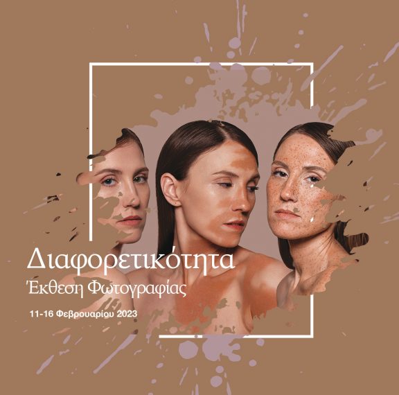 h-photoglobe-γιορτάζει-τη-διαφορετικότητα-με-τη