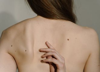δράση-πρόληψης-για-τον-καρκίνο-του-δέρ